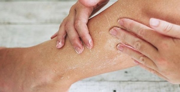 How To Get Rid Of Dry Patches On Body